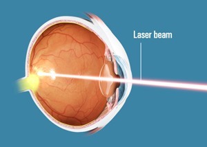 Laser Eye Surgery St. Leonards | Ophthalmic Lasers North Shore Laser Eye Surgery St. Leonards | Ophthalmic Lasers North Shore